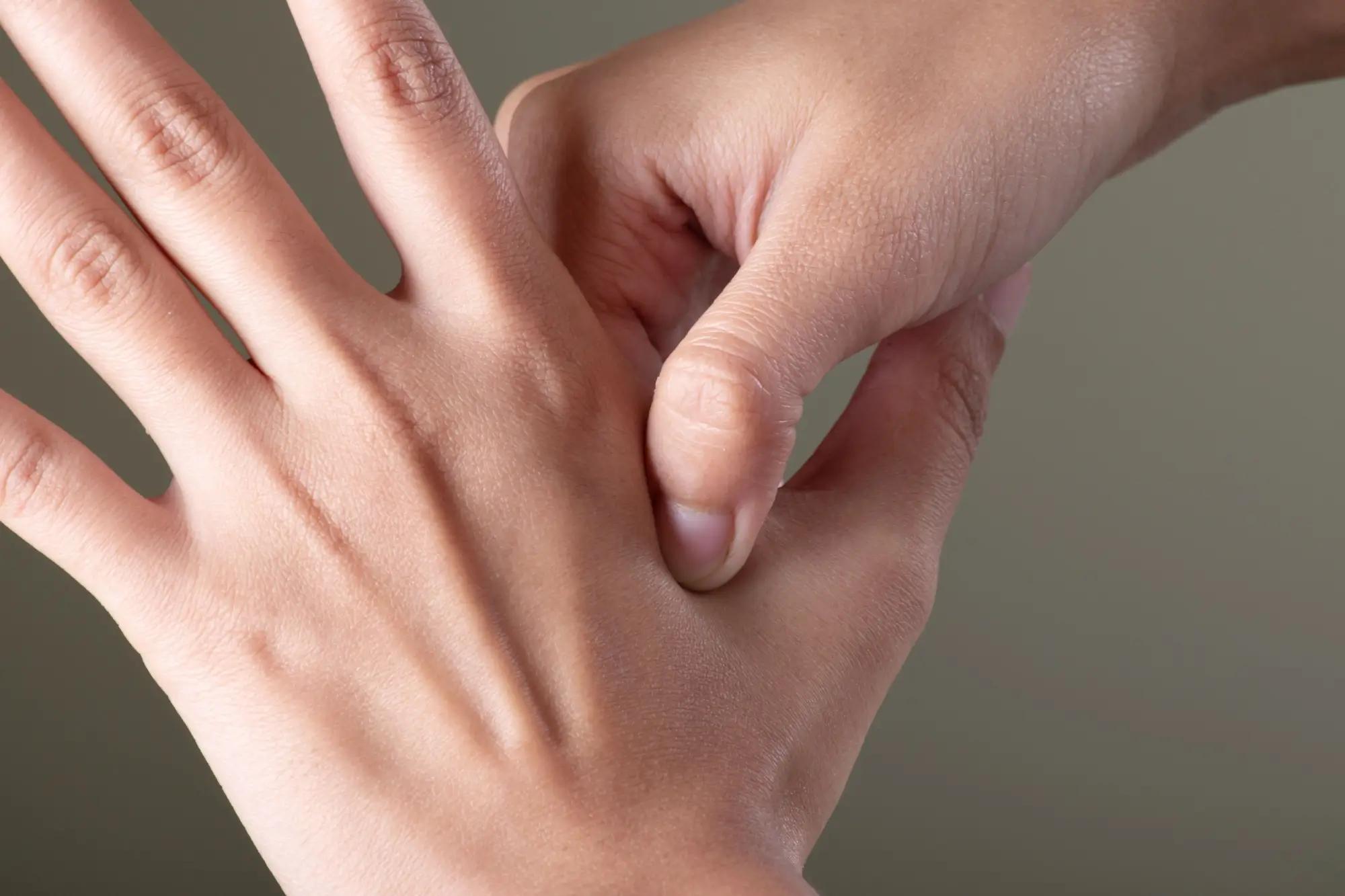 Akupresurní body na rukou.  