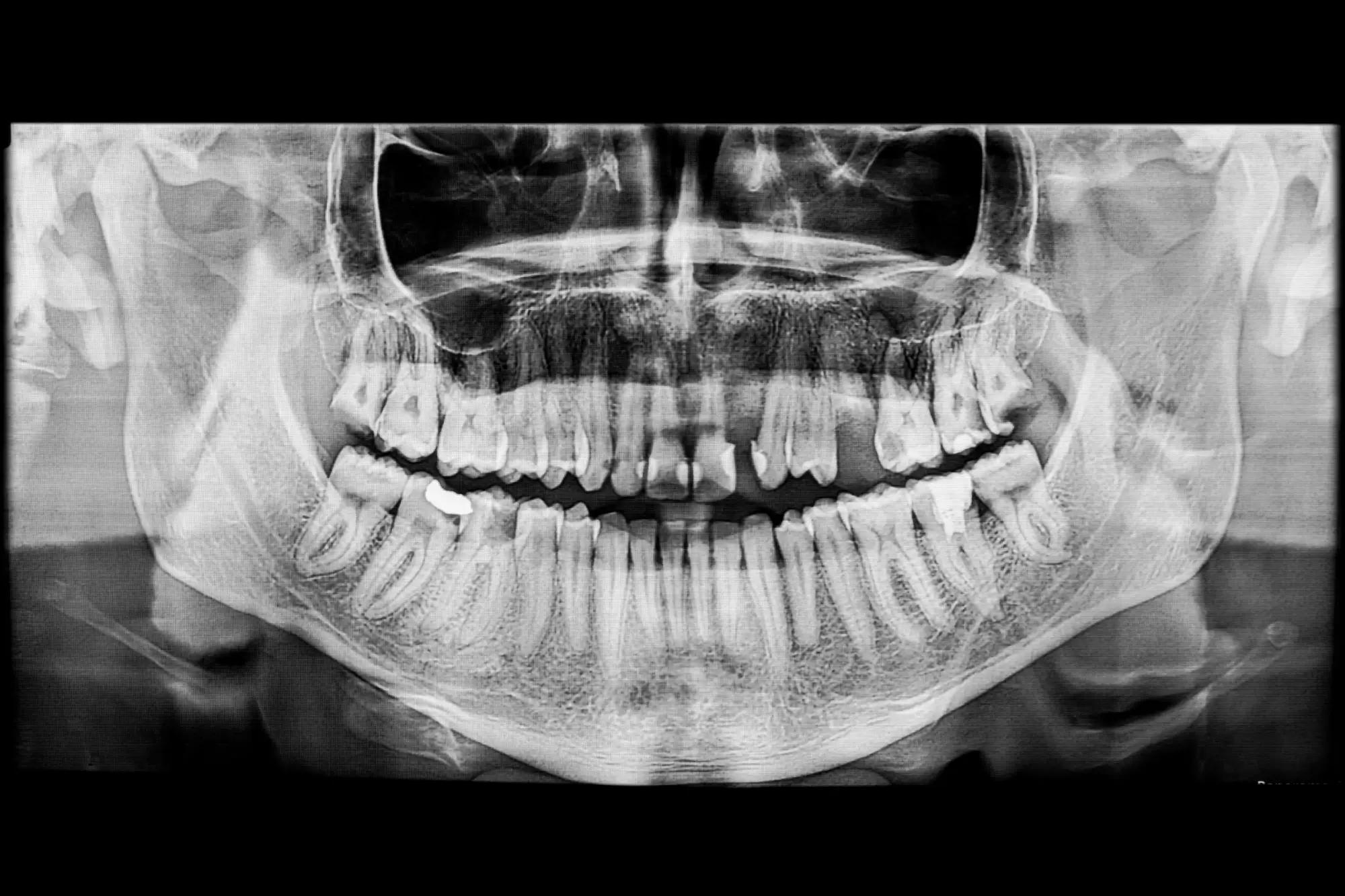 Poblémy se zuby má skoro každý dospělý. 