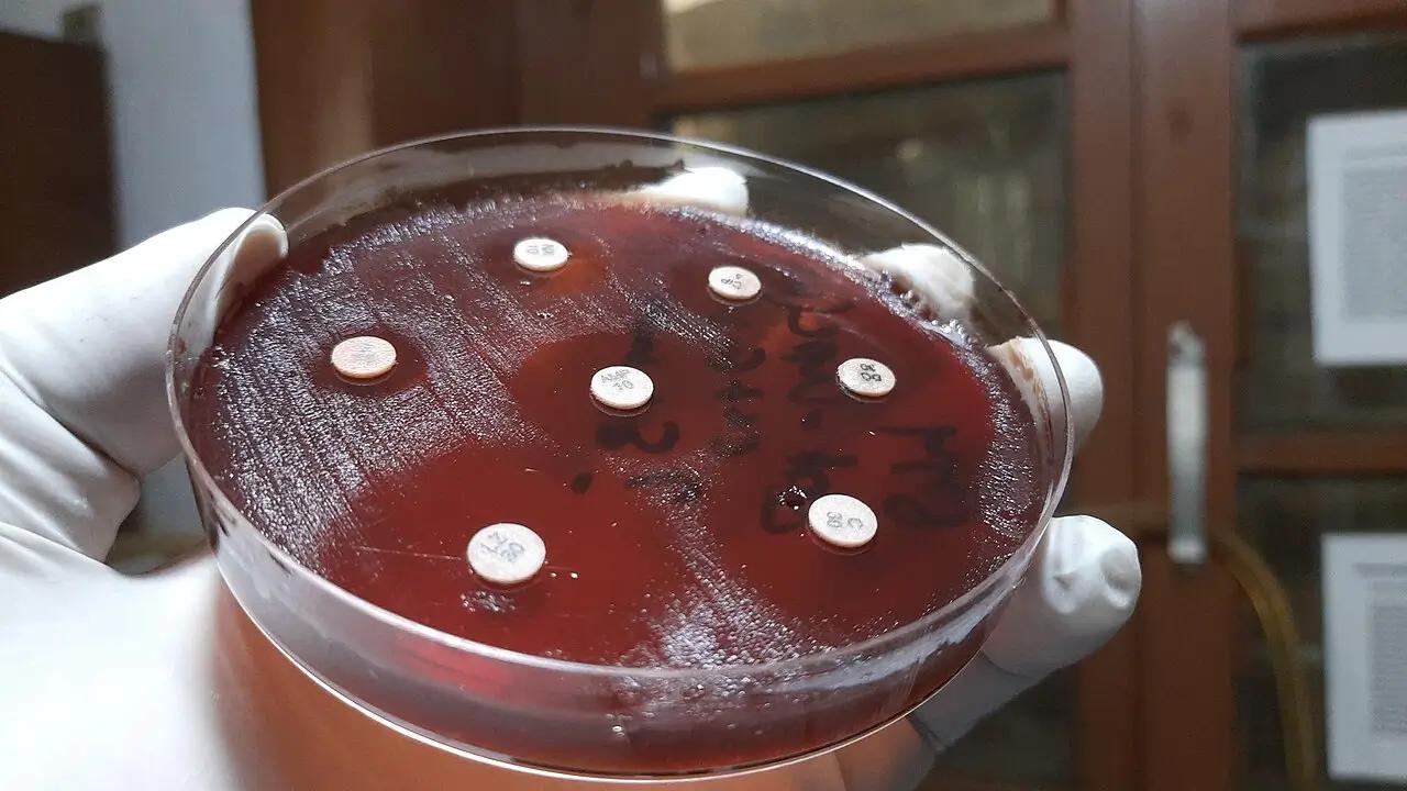 Test citlivosti antibiotik