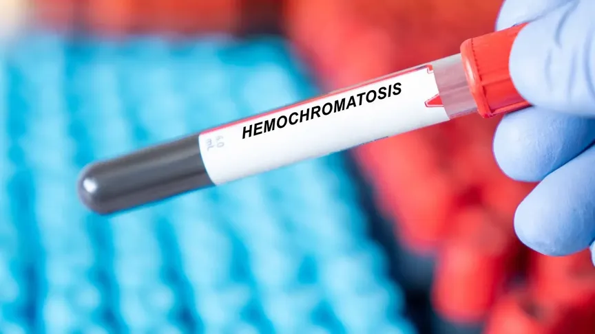 Zkumavka s nápisem Hemochromatosis
